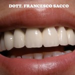 Dentista Salerno Dr. Francesco Sacco