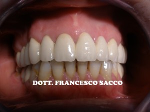 Dentista Salerno Dr. Francesco Sacco