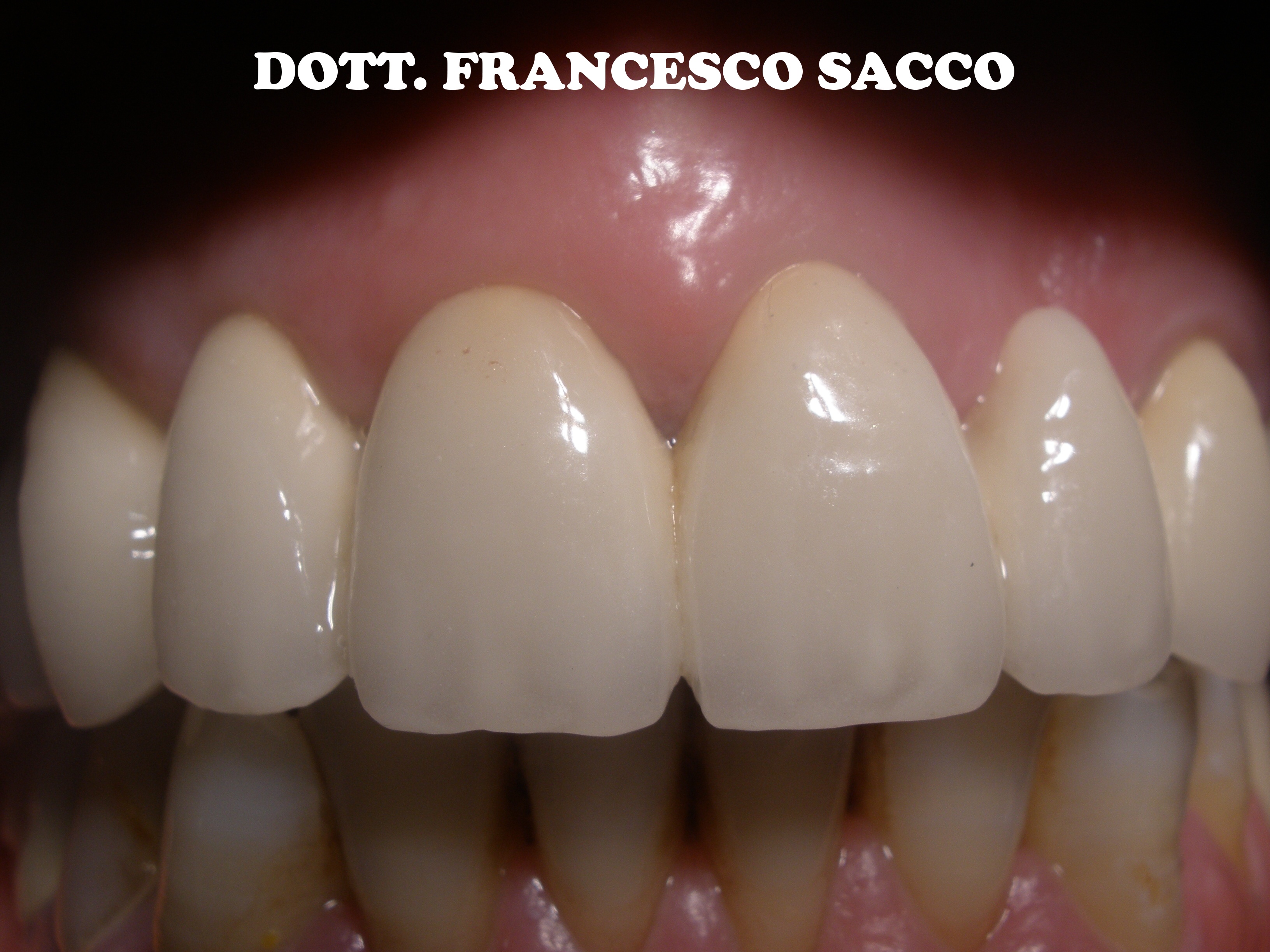 Dentista Salerno Dr. Francesco Sacco