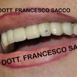 Dentista Salerno Dr.Sacco